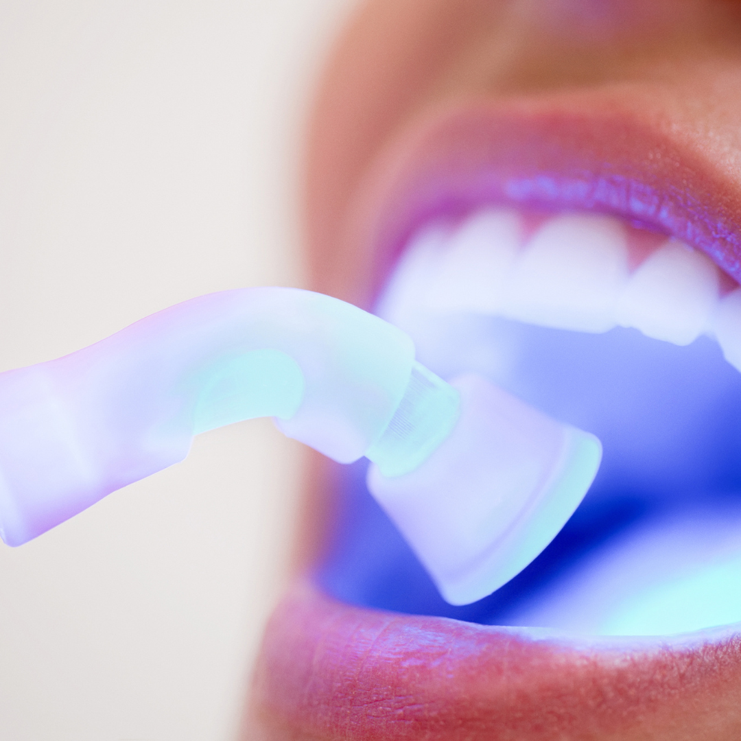 Types of Dental Fillings Pompano Beach FL