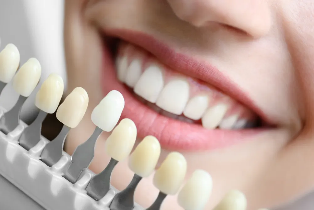 Benefits of Professional Cosmetic Dentistry Pompano Beach FL