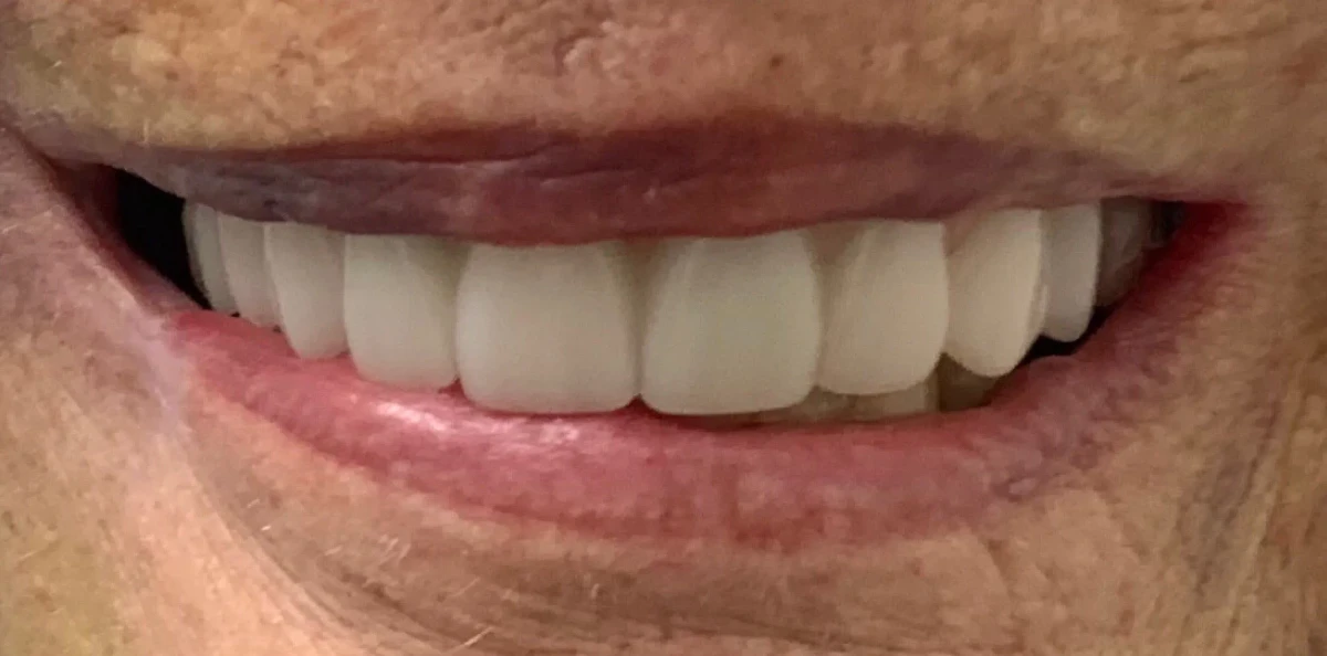 America's Bright Smiles in Pompano Beach, FL America's Bright Smiles in Pompano Beach, FL
