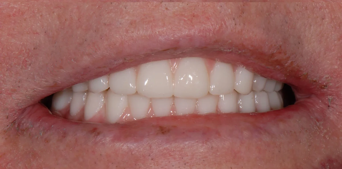 America's Bright Smiles in Pompano Beach, FL America's Bright Smiles in Pompano Beach, FL