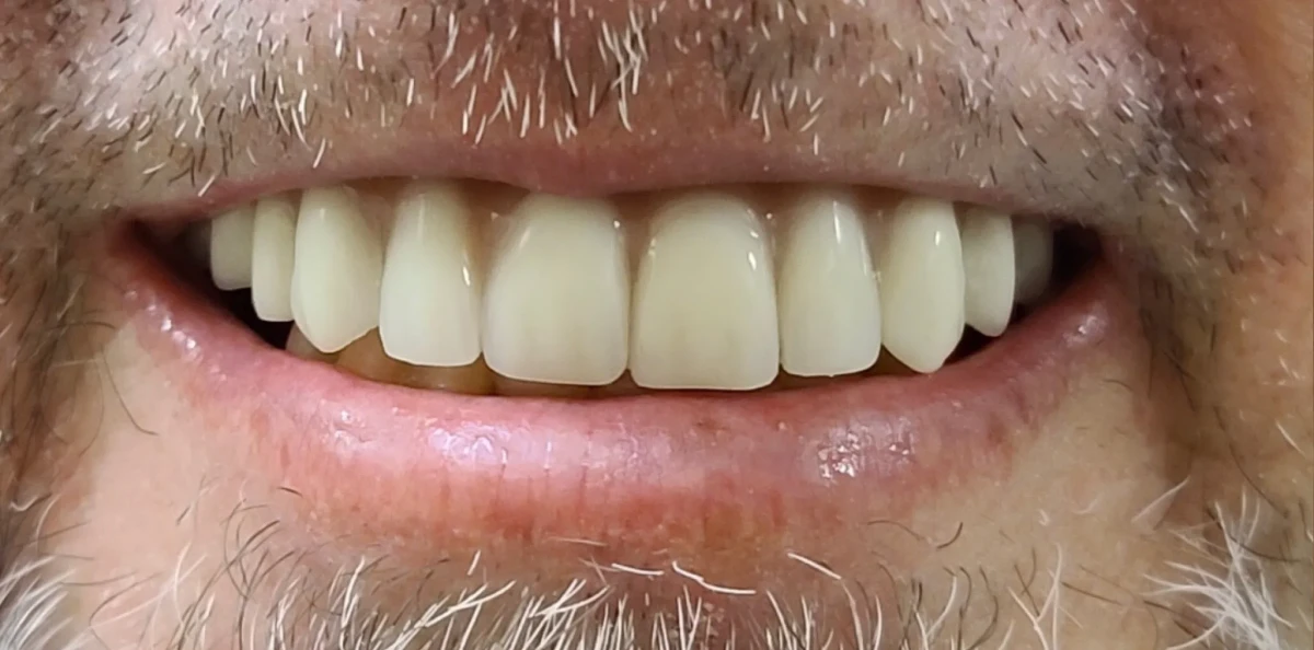 America's Bright Smiles in Pompano Beach, FL America's Bright Smiles in Pompano Beach, FL