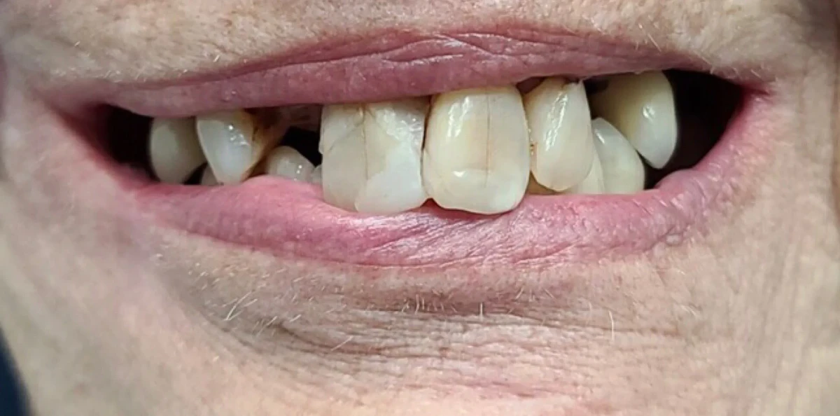 America's Bright Smiles in Pompano Beach, FL America's Bright Smiles in Pompano Beach, FL