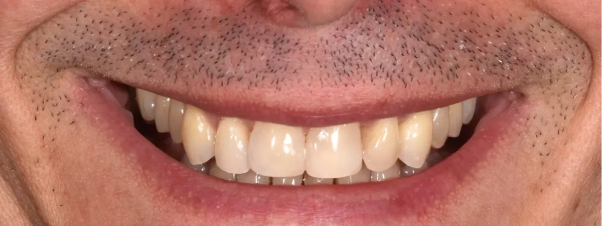 America's Bright Smiles in Pompano Beach, FL America's Bright Smiles in Pompano Beach, FL
