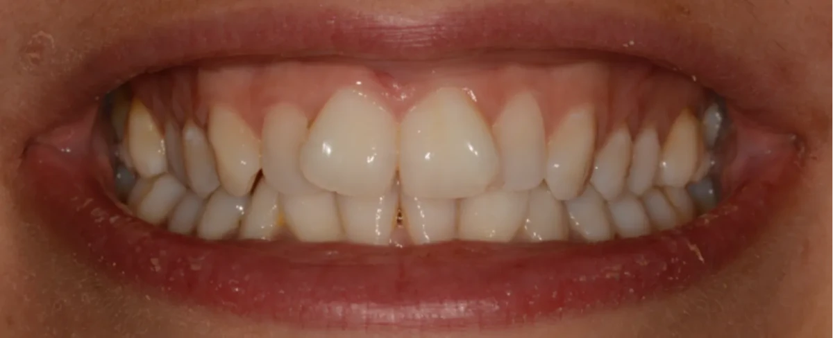 America's Bright Smiles in Pompano Beach, FL America's Bright Smiles in Pompano Beach, FL