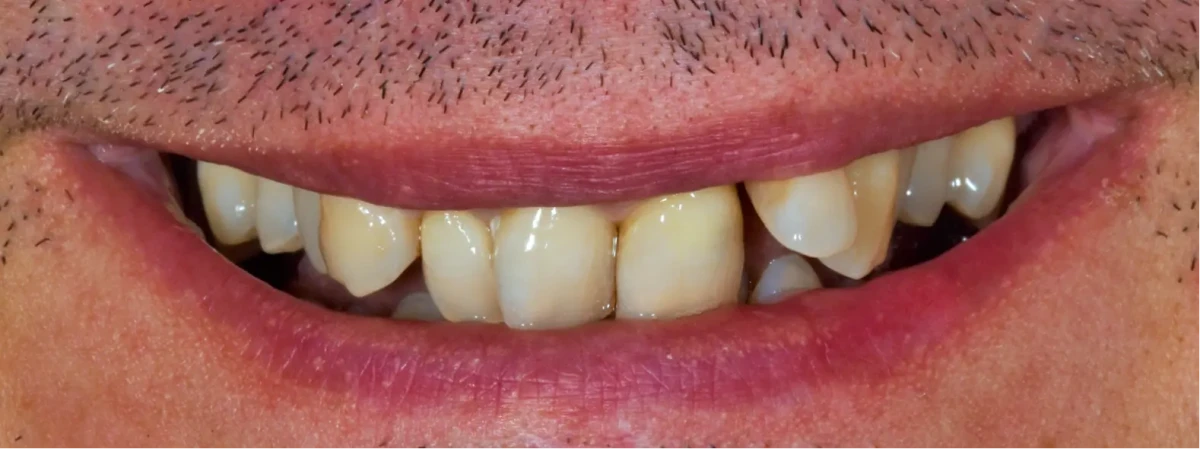 America's Bright Smiles in Pompano Beach, FL America's Bright Smiles in Pompano Beach, FL
