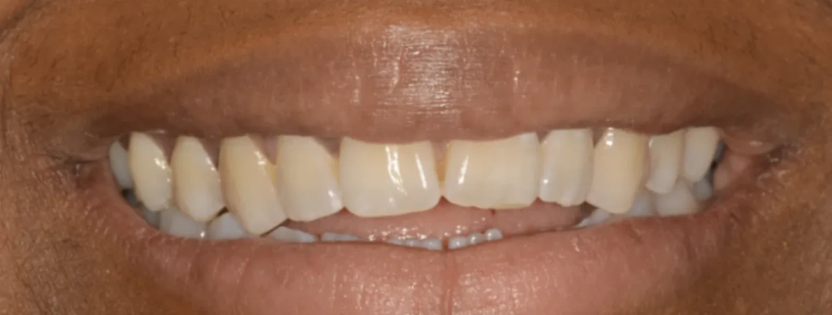 America's Bright Smiles in Pompano Beach, FL America's Bright Smiles in Pompano Beach, FL