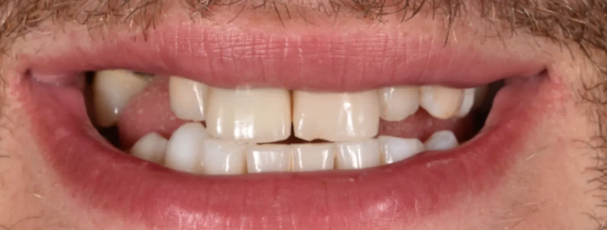 America's Bright Smiles in Pompano Beach, FL America's Bright Smiles in Pompano Beach, FL