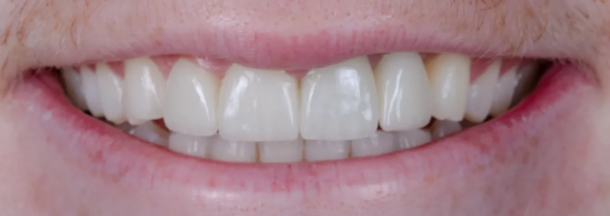 America's Bright Smiles in Pompano Beach, FL America's Bright Smiles in Pompano Beach, FL