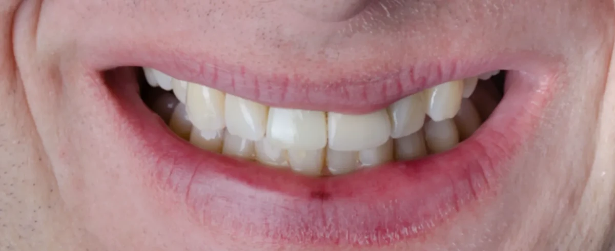 America's Bright Smiles in Pompano Beach, FL America's Bright Smiles in Pompano Beach, FL