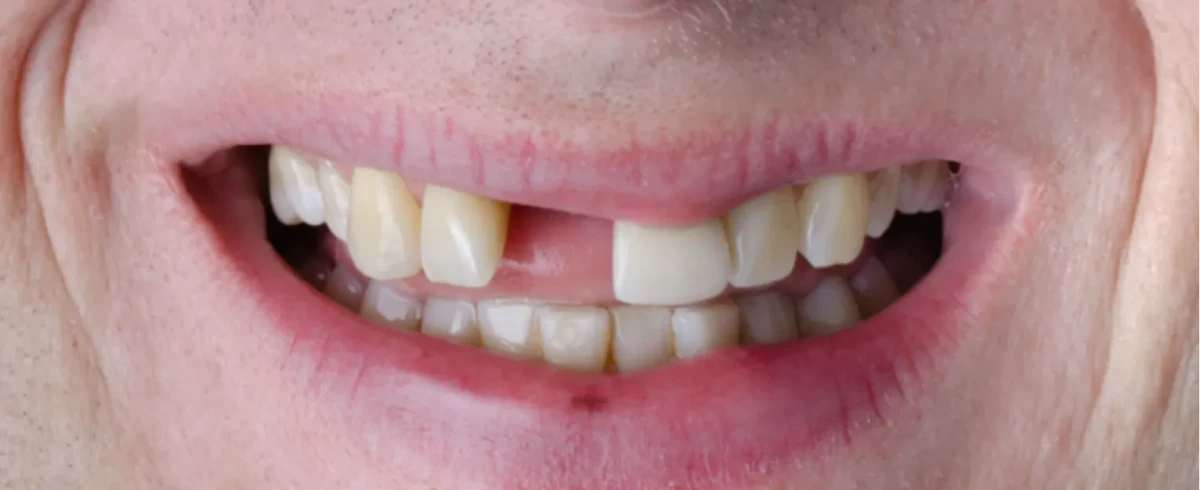 America's Bright Smiles in Pompano Beach, FL America's Bright Smiles in Pompano Beach, FL