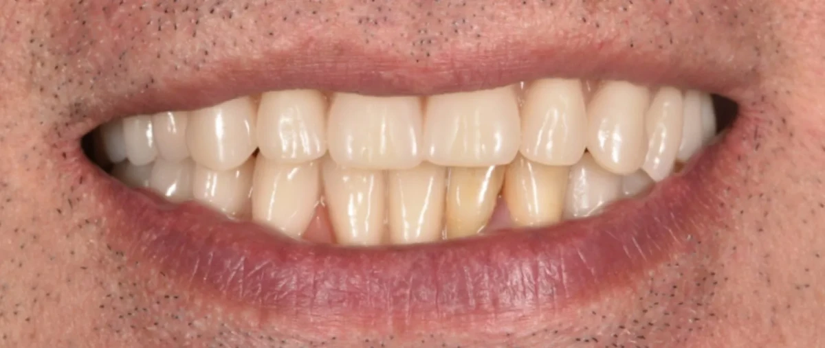 America's Bright Smiles in Pompano Beach, FL America's Bright Smiles in Pompano Beach, FL