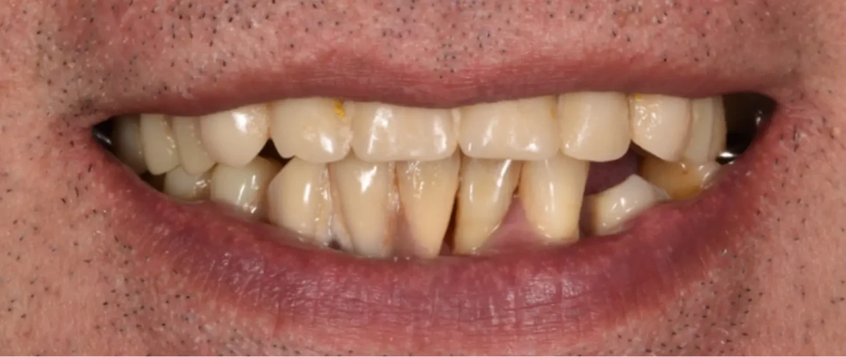 America's Bright Smiles in Pompano Beach, FL America's Bright Smiles in Pompano Beach, FL