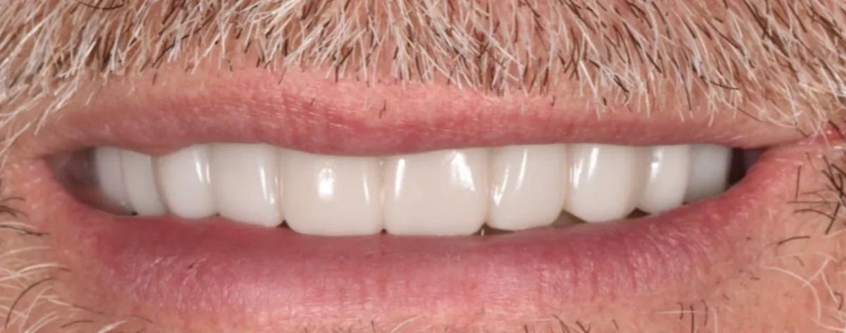 America's Bright Smiles in Pompano Beach, FL America's Bright Smiles in Pompano Beach, FL