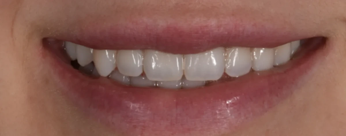 America's Bright Smiles in Pompano Beach, FL America's Bright Smiles in Pompano Beach, FL
