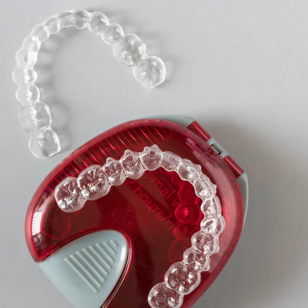 The Clear Aligner Treatment Process Pompano Beach FL