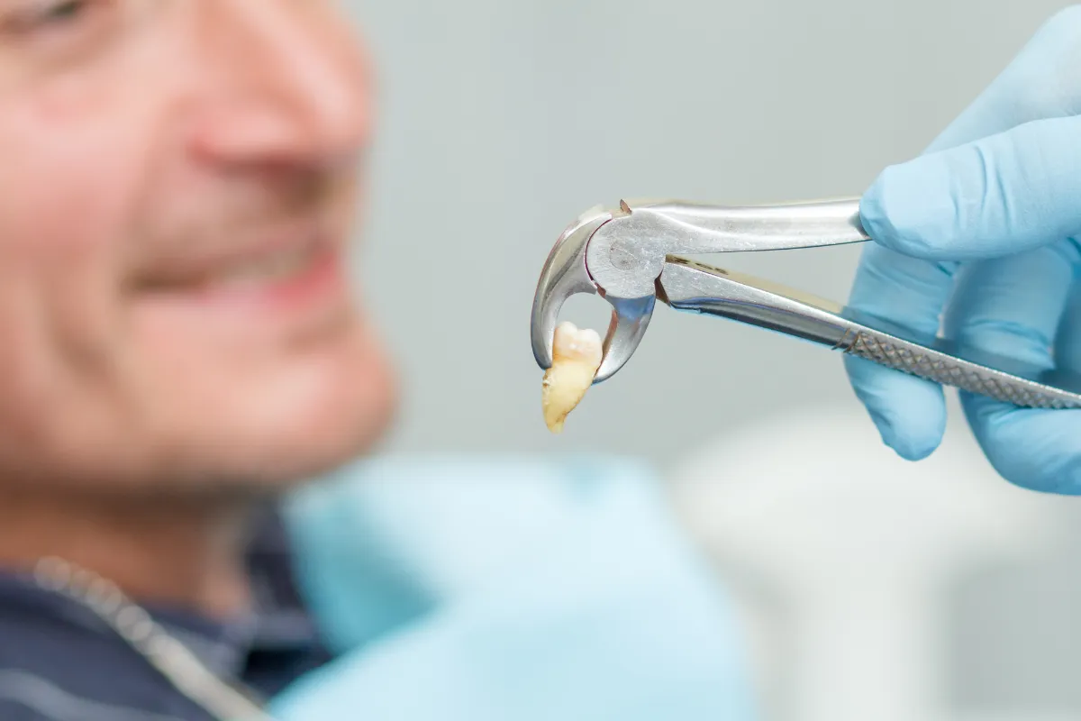 TOOTH EXTRACTIONS POMPANO BEACH, FL