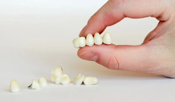 Dental Bridges Pompano Beach, FL
