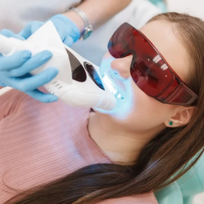 The Professional Whitening Process Pompano Beach FL