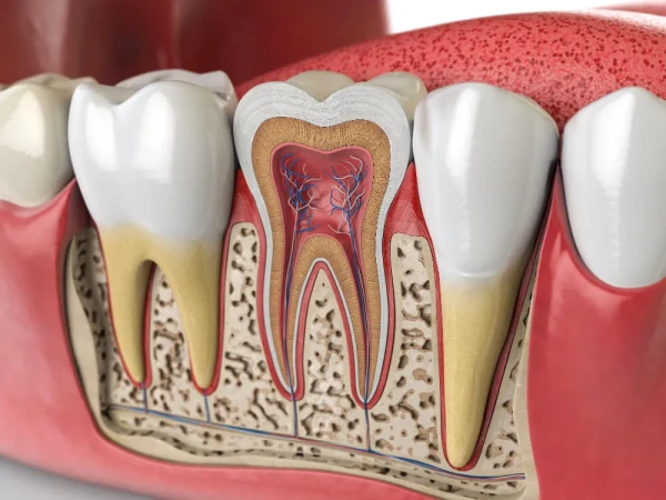 Understanding Root Canal Treatment Pompano Beach FL