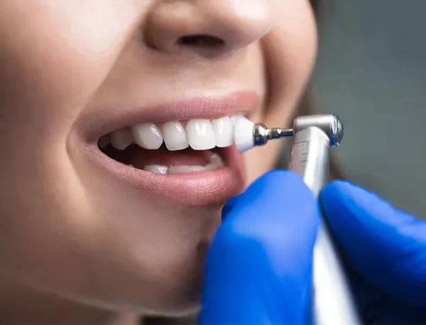What Are Dental Cleanings Pompano Beach FL
